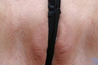 Crystal in Adrenalin from